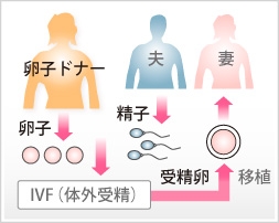 卵子提供